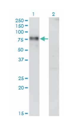 NR4A2, Mouse, Clone: 1C6, Abnova 100&mu;g; Unlabeled:Anticuerpos