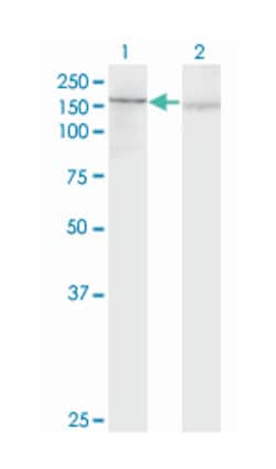 platelet-derived growth factor receptor, alpha polypeptide, Mouse, Clone: 2D2-1A11, Abnova™