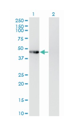 phosphorylase kinase, gamma 2 (testis), Mouse, Clone: 2F4, Abnova 100&mu;g;