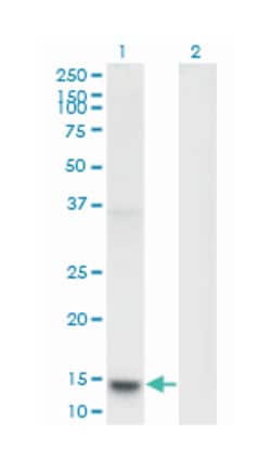 phospholipase A2, group IB (pancreas), Mouse, Clone: 2B7, Abnova 100&mu;g;