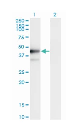 PLAUR, Mouse, Clone: 1D6, Abnova 100&mu;g; Unlabeled:Antibodies, Monoclonal