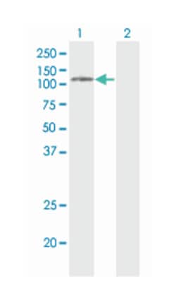phospholipase D2, Mouse, Clone: 1C5, Abnova™