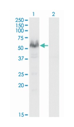 protein phosphatase 3 (formerly 2B), catalytic subunit, alpha isoform,