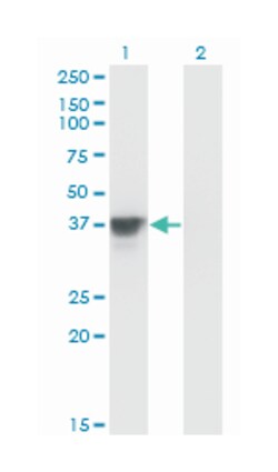 mitogen-activated protein kinase kinase 3, Mouse, Clone: 1D10, Abnova 100&mu;g;