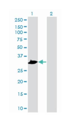 PRPS1, Mouse, Polyclonal Antibody, Abnova 50&mu;L; Unlabeled:Antibodies,