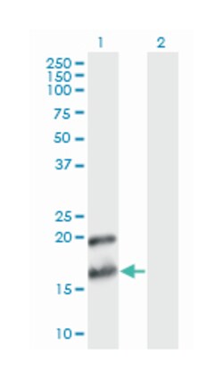 pleiotrophin, Mouse, Clone: 2E3, Abnova 100&mu;g; Unlabeled:Antibodies,
