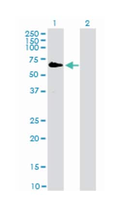 v-raf-1 murine leukemia viral oncogene homolog 1, Mouse, Clone: 1H4, Abnova 100 &mu;g | Buy Online | Abnova | Fisher Scientific