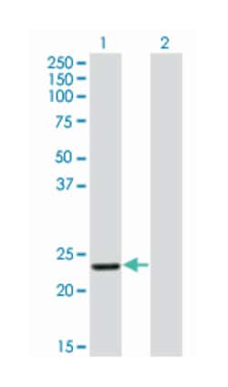 RCV1, Mouse, Clone: 1D3, Abnova 200&mu;L; Unlabeled:Antibodies, Monoclonal