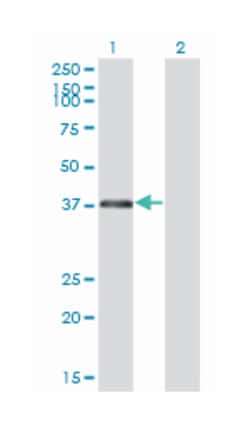ring finger protein 2, Mouse, Clone: 6C2, Abnova 100 &mu;g | Buy Online | Abnova Corporation | Fisher Scientific
