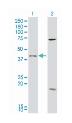 secreted frizzled-related protein 4, Mouse, Polyclonal Antibody, Abnova