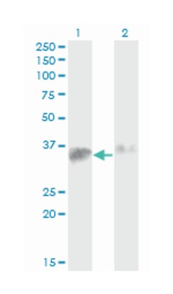 anti-SMN2, Clone: 1A3-2B9, Abnova 100&mu;g; Unlabeled:Antibodies, Monoclonal