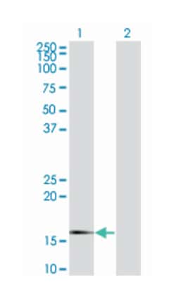 SNCG, Mouse, Clone: 2C3, Abnova 200&mu;L; Unlabeled:Antibodies, Monoclonal