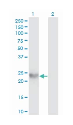 small proline-rich protein 3, Mouse, Clone: 4A12, Abnova 100&mu;g; Unlabeled:Antibodies,