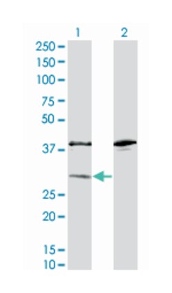 sulfotransferase family, cytosolic, 1A, phenol-preferring, member 1, Mouse, Clone: 1F8, Abnova 200 &mu;L | Buy Online | Abnova Corporation | Fisher Scientific