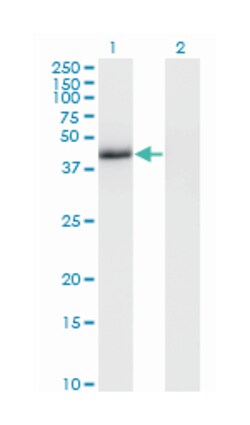 T, brachyury homolog (mouse), Mouse, Clone: 5C5, Abnova 100&mu;g; Unlabeled:Antibodies,