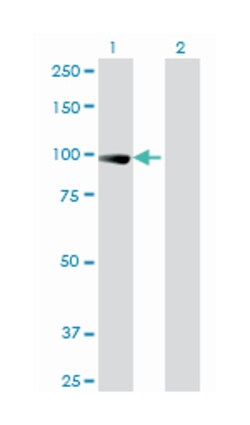 transcription elongation factor B (SIII), polypeptide 3 (110kDa, elongin