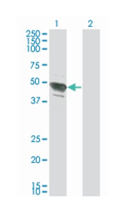 transcription factor AP-2 beta (activating enhancer binding protein 2 beta),