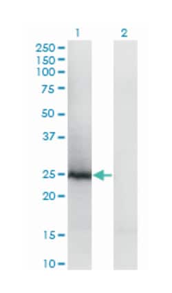 translin, Mouse, Polyclonal Antibody, Abnova 50 &mu;L | Buy Online | Abnova Corporation | Fisher Scientific