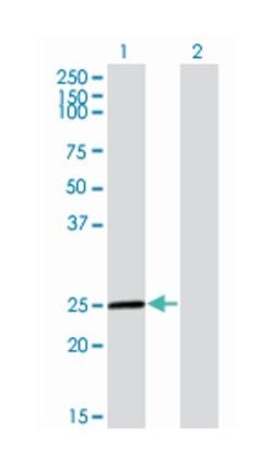 twist homolog 1 (Drosophila), Mouse, Clone: 2F8, Abnova 100&mu;g; Unlabeled:Antibodies,