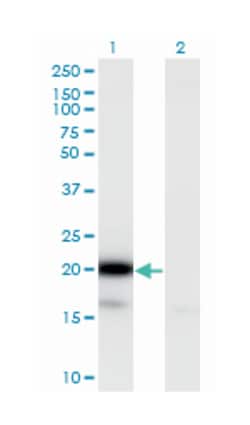 ubiquitin-conjugating enzyme E2G 2 (UBC7 homolog, yeast), Mouse, Clone: