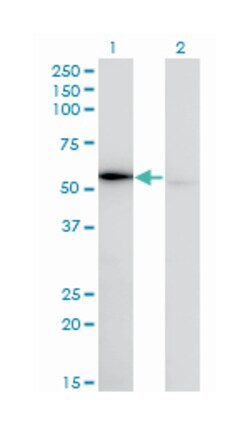 tryptophanyl-tRNA synthetase, Mouse, Clone: 3A12, Abnova 100&mu;g; Unlabeled:Antibodies,