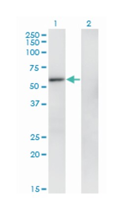 zinc finger protein 207, Mouse, Clone: 6D7, Abnova 100&mu;g; Unlabeled:Antibodies,