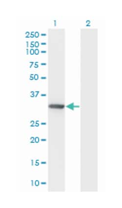 dynein, axonemal, light intermediate chain 1, Mouse, Clone: 2H3, Abnova