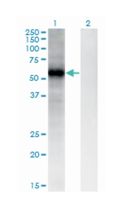 FZD4, Mouse, Clone: 3G7, Abnova 200&mu;L; Unlabeled:Antibodies, Monoclonal
