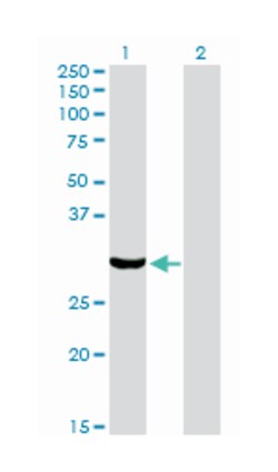 protein kinase, interferon-inducible double stranded RNA dependent activator,