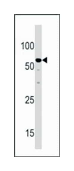 NCAPH2, Rabbit, Polyclonal Antibody, Abnova 400 &mu;L | Buy Online | Abnova Corporation | Fisher Scientific