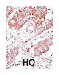 BMPR1A Rabbit anti-Human, Mouse, Polyclonal Antibody, Abnova 400 &mu;L | Buy Online | Abnova Corporation | Fisher Scientific
