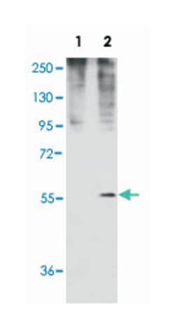 GDF11, Rabbit, Polyclonal Antibody, Abnova 400 &mu;L | Buy Online | Abnova Corporation | Fisher Scientific