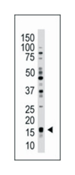 UBE2L3 Rabbit anti-Human, Polyclonal Antibody, Abnova 400 &mu;L | Buy Online | Abnova Corporation | Fisher Scientific