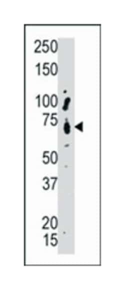 PTPN9, Rabbit, Polyclonal Antibody, Abnova 400&mu;L; Unlabeled:Antibodies,