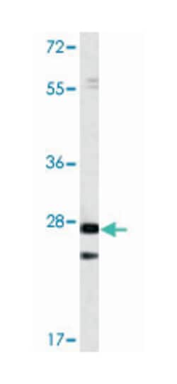 PTP4A1, Rabbit, Polyclonal Antibody, Abnova 400 &mu;L | Buy Online | Abnova Corporation | Fisher Scientific