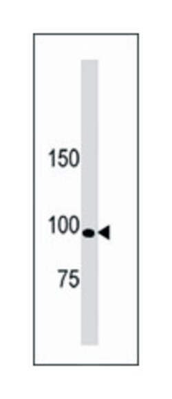 LLGL1, Rabbit, Polyclonal Antibody, Abnova 400 &mu;L | Buy Online | Abnova Corporation | Fisher Scientific