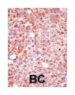 MGAT3, Rabbit, Polyclonal Antibody, Abnova 400 &mu;L | Buy Online | Abnova Corporation | Fisher Scientific
