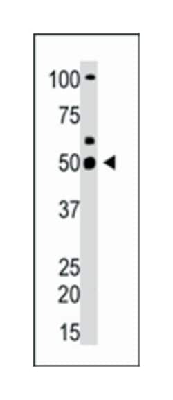 YY1 Rabbit anti-Human, Polyclonal Antibody, Abnova 400&mu;L; Unlabeled:Antibodies,
