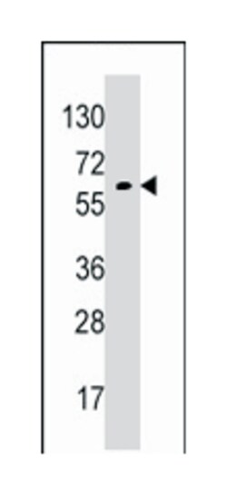 GPC6 Rabbit anti-Human, Polyclonal Antibody, Abnova 400&mu;L; Unlabeled:Antibodies,