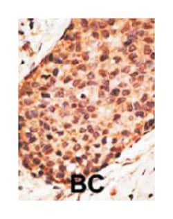 MMP16 Rabbit anti-Human, Polyclonal Antibody, Abnova 400&mu;L; Unlabeled:Antibodies,