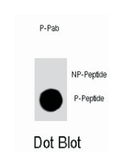 CDKN1B (phospho T198), Rabbit anti-Human, Polyclonal Antibody, Abnova 400 &mu;L | Buy Online | Abnova | Fisher Scientific