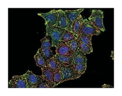 TFRC, Mouse, Clone: MEM-75, Abnova 100 &mu;g | Buy Online | Abnova Corporation | Fisher Scientific