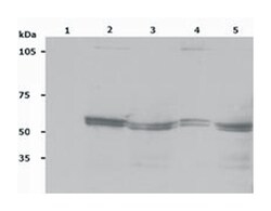 LYN, Mouse, Clone: LYN-01, Abnova 100&mu;g; Unlabeled:Antibodies, Monoclonal
