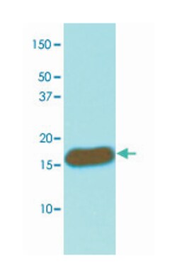 CRABP2, Mouse, Clone: AT2E11, Abnova 100&mu;L; Unlabeled:Antibodies, Monoclonal