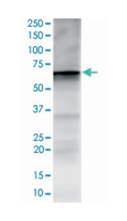GPC3, Rabbit, Clone: SP86, Abnova 100&mu;L; Unlabeled:Antibodies, Monoclonal