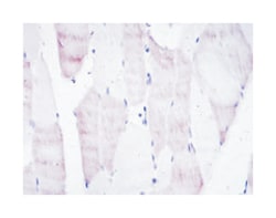 OLIG2, Mouse, Clone: 1G11, Abnova 100&mu;L; Unlabeled:Antibodies, Monoclonal