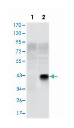 OLIG2, Mouse, Clone: 1G11, Abnova 100&mu;L; Unlabeled:Antibodies, Monoclonal