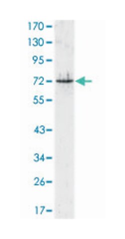 PRTN3, Mouse, Clone: 3B4, Abnova 100&mu;L; Unlabeled:Antibodies, Monoclonal