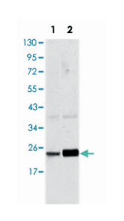 RAB10, Mouse, Clone: 4E2, Abnova 100&mu;L; Unlabeled:Antibodies, Monoclonal