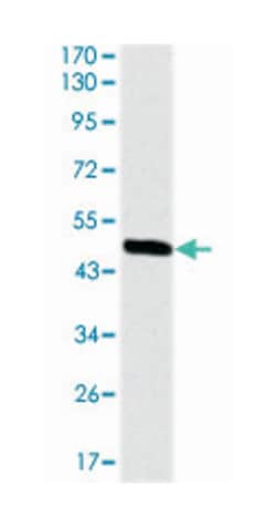 RAF1, Mouse, Clone: 4G4, Abnova 100&mu;L; Unlabeled:Antistoffer